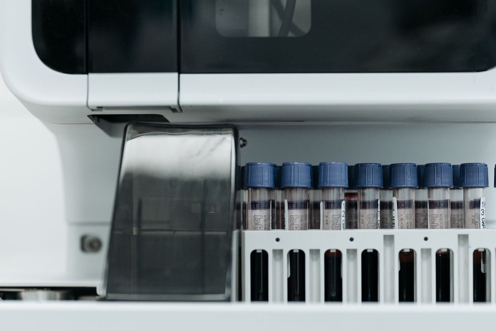 A rack of capped specimen tubes waiting at the loading port of a clinical analyzer